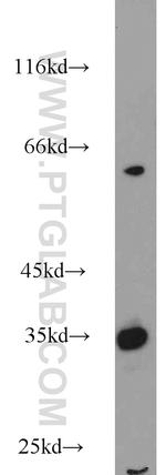 SULT1C2 Antibody in Western Blot (WB)