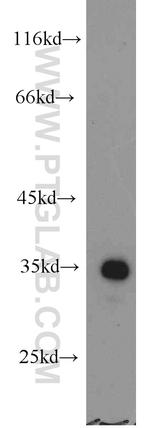 SULT1C2 Antibody in Western Blot (WB)