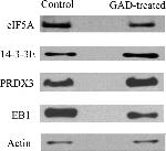 PRDX3 Antibody in Western Blot (WB)