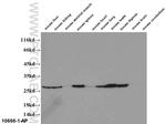 PMM2 Antibody in Western Blot (WB)