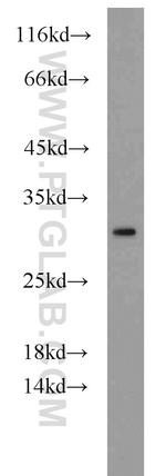 PMM2 Antibody in Western Blot (WB)