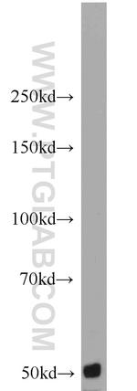 CARD9 Antibody in Western Blot (WB)