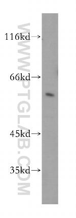 CARD9 Antibody in Western Blot (WB)