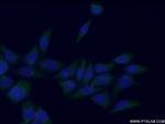 SPHK1 Antibody in Immunocytochemistry (ICC/IF)