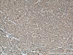 SPHK1 Antibody in Immunohistochemistry (Paraffin) (IHC (P))