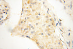 OSTF1 Antibody in Immunohistochemistry (Paraffin) (IHC (P))