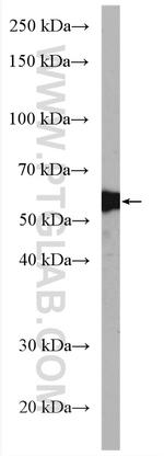 Carboxypeptidase B2 Antibody in Western Blot (WB)
