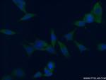 FABP3 Antibody in Immunocytochemistry (ICC/IF)