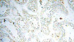 FABP3 Antibody in Immunohistochemistry (Paraffin) (IHC (P))