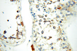 FABP3 Antibody in Immunohistochemistry (Paraffin) (IHC (P))