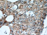 FABP3 Antibody in Immunohistochemistry (Paraffin) (IHC (P))