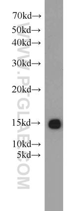 FABP3 Antibody in Western Blot (WB)