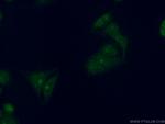 RGS2 Antibody in Immunocytochemistry (ICC/IF)