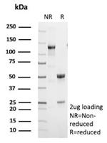 CETN1/Centrin-1 Antibody in SDS-PAGE (SDS-PAGE)