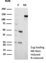 CETN1/Centrin-1 Antibody in SDS-PAGE (SDS-PAGE)