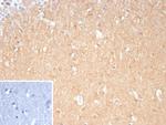 DLL3/SCDO1 Monoclonal Antibody (DLL3/9361)