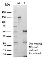 DLL3/SCDO1 Antibody in SDS-PAGE (SDS-PAGE)