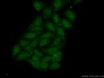 MBIP Antibody in Immunocytochemistry (ICC/IF)