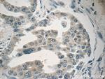 MBIP Antibody in Immunohistochemistry (Paraffin) (IHC (P))