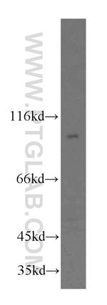 AGO2 Antibody in Western Blot (WB)