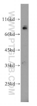 AGO2 Antibody in Western Blot (WB)