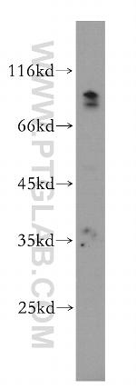 AGO2 Antibody in Western Blot (WB)