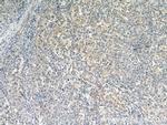 RERG Antibody in Immunohistochemistry (Paraffin) (IHC (P))