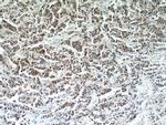 RERG Antibody in Immunohistochemistry (Paraffin) (IHC (P))
