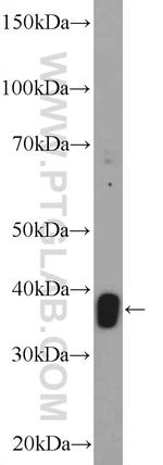 STRADB Antibody in Western Blot (WB)