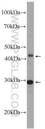 STRADB Antibody in Western Blot (WB)