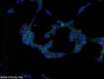 MMS2 Antibody in Immunocytochemistry (ICC/IF)