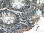 MMS2 Antibody in Immunohistochemistry (Paraffin) (IHC (P))