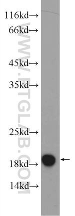 MMS2 Antibody in Western Blot (WB)