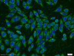 MMS2 Antibody in Immunocytochemistry (ICC/IF)