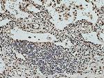 RPA3 Antibody in Immunohistochemistry (Paraffin) (IHC (P))