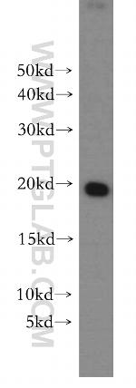 MPHOSPH6 Antibody in Western Blot (WB)