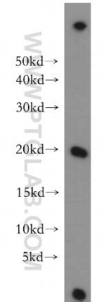 MPHOSPH6 Antibody in Western Blot (WB)