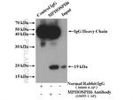 MPHOSPH6 Antibody in Western Blot (WB)
