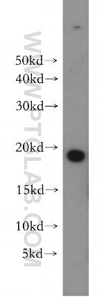 MPHOSPH6 Antibody in Western Blot (WB)