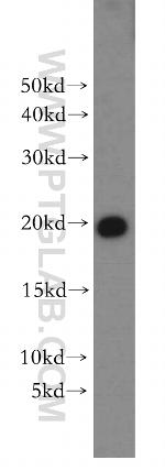 MPHOSPH6 Antibody in Western Blot (WB)