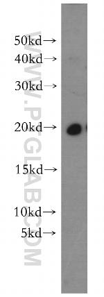 MPHOSPH6 Antibody in Western Blot (WB)