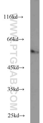 FBXO7 Antibody in Western Blot (WB)
