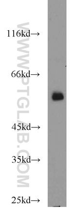 FBXO7 Antibody in Western Blot (WB)