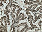 RCC1 Antibody in Immunohistochemistry (Paraffin) (IHC (P))