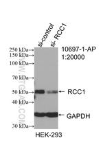 RCC1 Antibody in Western Blot (WB)