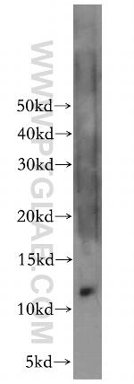 LSM5 Antibody in Western Blot (WB)