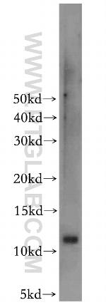 LSM5 Antibody in Western Blot (WB)