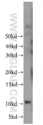 LSM5 Antibody in Western Blot (WB)