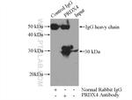 PRDX4 Antibody in Immunoprecipitation (IP)