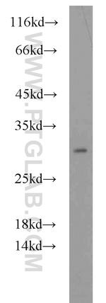 PRDX4 Antibody in Western Blot (WB)